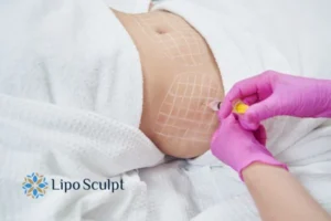 Are The Results From Aqualyx Permanent? 1 Do you want to know how long Aqualyx Burnt Tree results last?