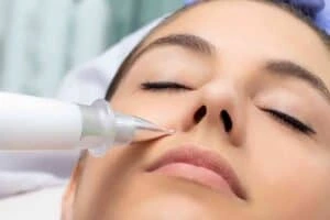 Best Actinic Keratoses Removal 3 Actinic keratoses Burnt Tree solutions - book in today!
